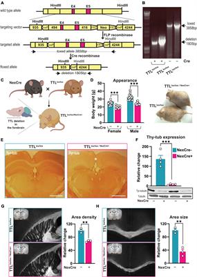 The role of α-tubulin tyrosination in controlling the structure and function of hippocampal neurons